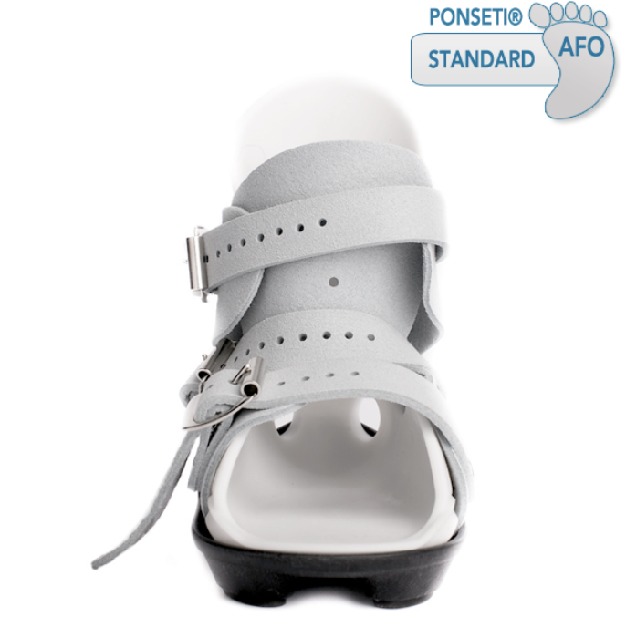 Clubfoot AFO MD Orthopaedics Clubfoot/Ponseti
